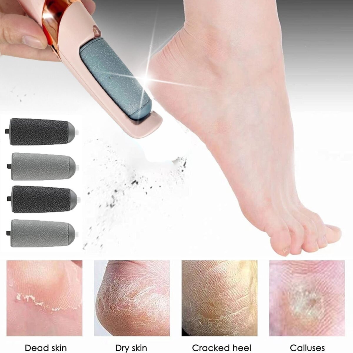 electric foot pedicure machine 935412.jpg